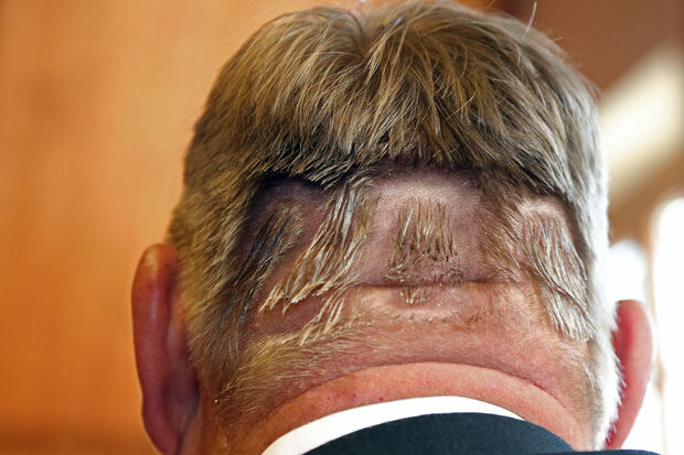 Getränke-Offizier Heinz-Jürgen Meyer, genannt "Amboss", hatte sich auf Grund des 200-jährigen Bestehens der Schützenbruderschaft St. Vinzentius eigens von einem Frisör die Jahreszahl "200" in die Haare schneiden lassen. ARCHIVFOTO: ANDREAS DUNKER